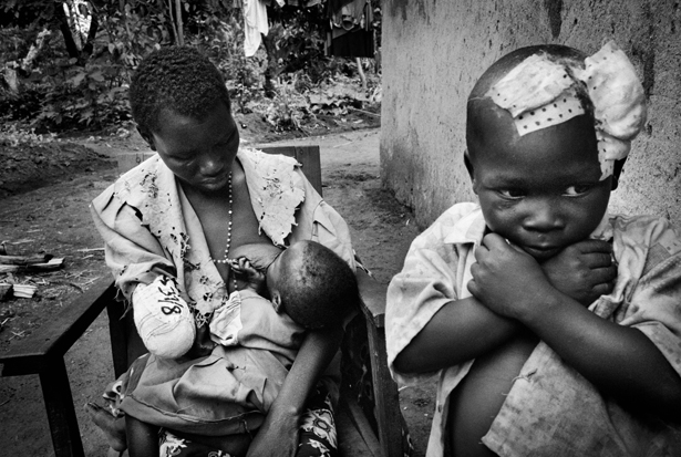 A Congo Mother Survives Cannibalism To Save Her Children: Why Her Photo ...